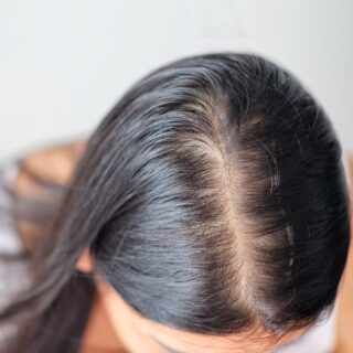 reasons why hair parting is getting wider