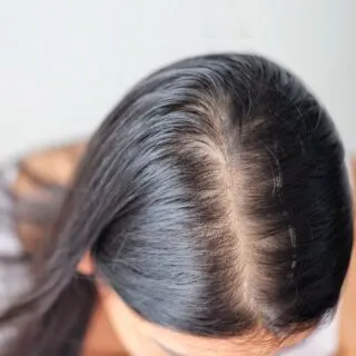 reasons why hair parting is getting wider