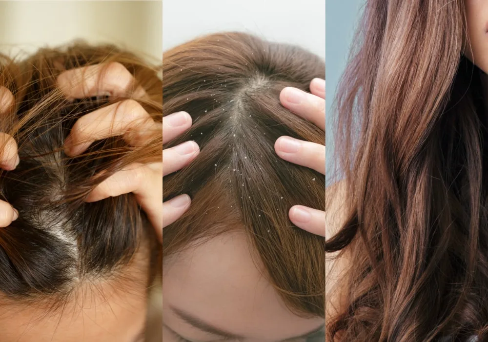 Side Effects of Daily Hairspray Usage
